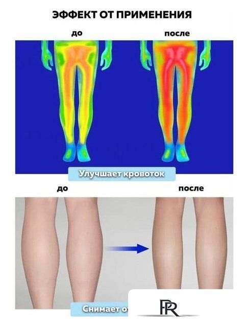 Массажер для ног Planta MFC-80 - Изображение №10 — Интернет-магазин ПроЗаказ