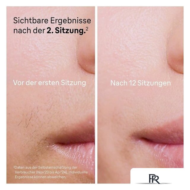 Фотоэпилятор Braun Silk-Expert Pro 5 PL5140 - Изображение №4 — Интернет-магазин ПроЗаказ