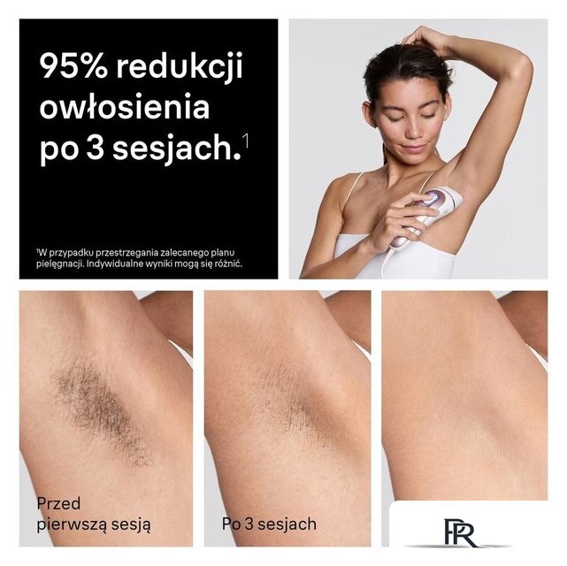 Фотоэпилятор Braun Skin i-expert Pro IPL PL7432 - Изображение №9 — Интернет-магазин ПроЗаказ