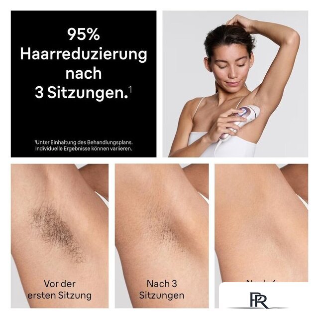 Фотоэпилятор Braun Skin i-Expert PL7321 - Изображение №6 — Интернет-магазин ПроЗаказ
