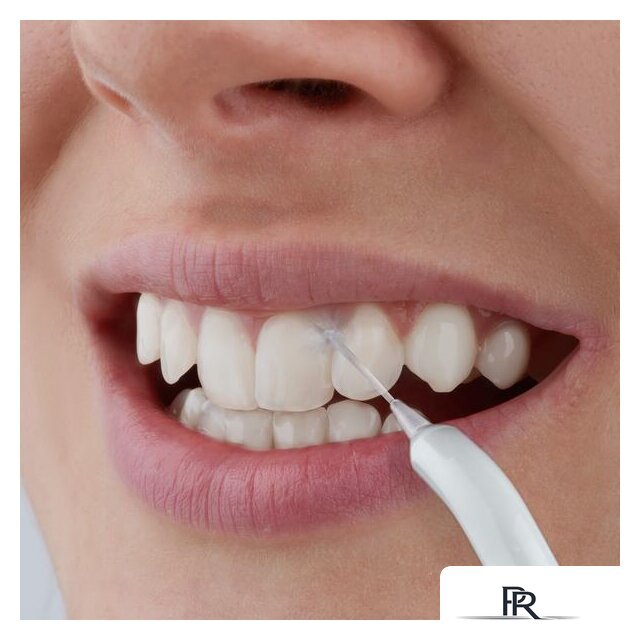 Ирригатор  Sencor SOI 1100SL - Изображение №13 — Интернет-магазин ПроЗаказ