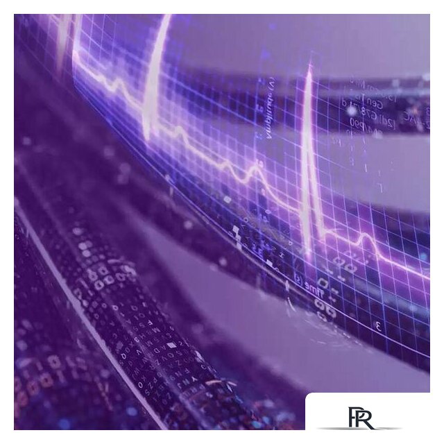 Жесткий диск WD Purple Pro 18TB WD181PURP - Изображение №9 — Интернет-магазин ПроЗаказ