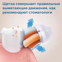 Электрическая зубная щетка Philips HX9992/11 - Превью изображения №2 — Интернет-магазин ПроЗаказ