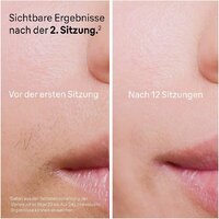 Фотоэпилятор Braun Silk-Expert Pro 5 PL5140 - Превью изображения №4 — Интернет-магазин ПроЗаказ