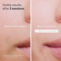 Фотоэпилятор Braun Silk-expert Pro 5 PL5242 - Превью изображения №4 — Интернет-магазин ПроЗаказ