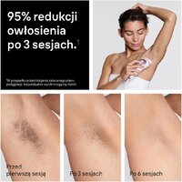 Фотоэпилятор Braun Skin i-expert Pro IPL PL7432 - Превью изображения №9 — Интернет-магазин ПроЗаказ