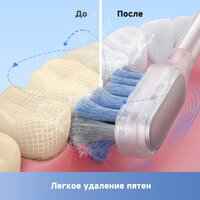 Электрическая зубная щетка Trouver 3D Clean Electric Toothbrush ATB15A (серебристый) - Превью изображения №9 — Интернет-магазин ПроЗаказ
